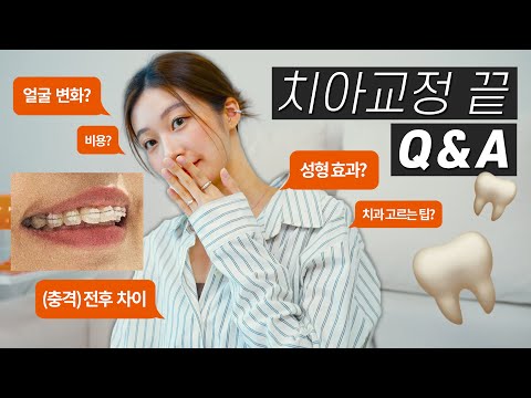 치아교정 끝!!🦷 교정 Q&A 후기 총정리 (충격적인 전후사진 공개, 얼굴변화, 총 비용💵, 장단점, 통증, 종류)