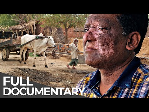 Extreme India: Cow Vigilantes, Disabled Dating & More | Unreported World | Free Documentary