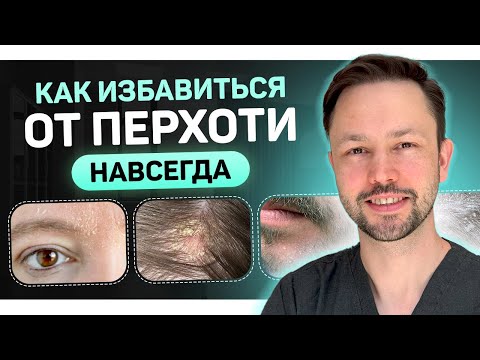 Dandruff. Real Causes. How to Get Rid of It Forever?