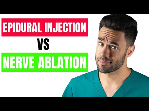 Epidural Steroid Injection vs Radiofrequency Ablation for Low Back Pain Relief!