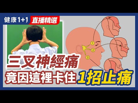 三叉神經痛  竟因為這裡卡住 1招止痛