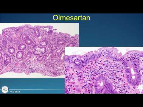 The Celiac Mimickers