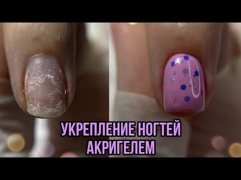 Укрепление акригелем/восстановление ногтей/форма четкий квадрат