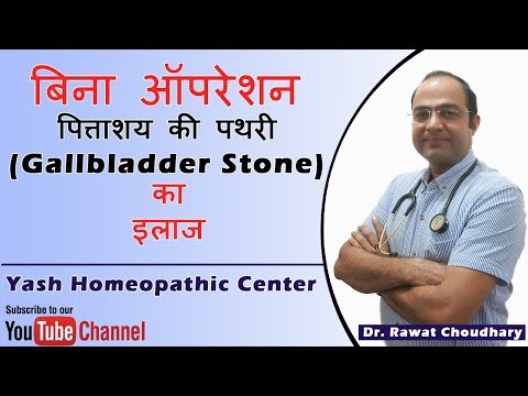 पित्ताशय की पथरी (Gallbladder Stone) का बिना ऑपरेशन के इलाज | Yash Homeopathic Center