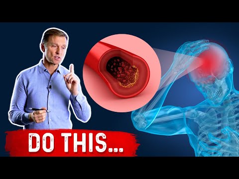 At the 1st Sign of a Stroke: DO THIS...