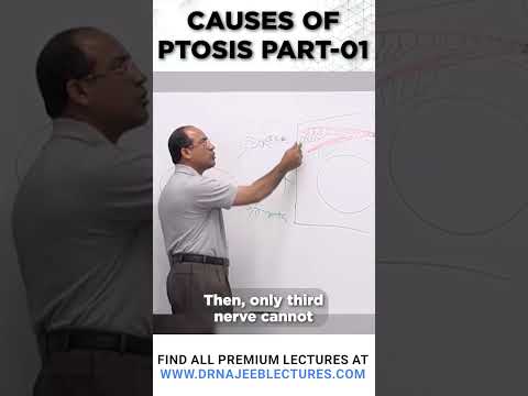 Causes Of Ptosis Part 01 #drnajeeblectures #drnajeeb #shortvideo