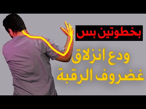 علاج انزلاق غضروف الرقبة وتنميل اليد بدون جراحة/بخطوتين بس تخلص من الانزلاق الغضروفي العنقي