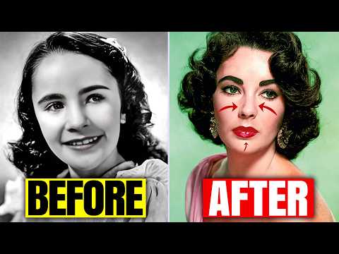 21 Secret Surgeries That Transformed Golden Age Stars Forever. #3 Is SHOCKING!