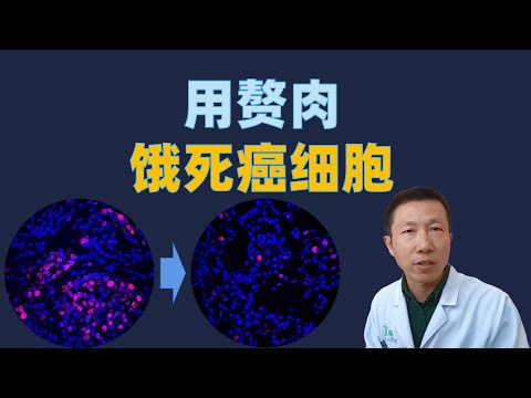 为什么癌症难以治愈?最新科学发现,利用赘肉可以饿死癌细胞
