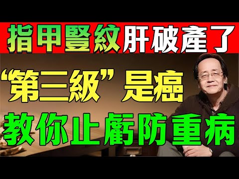 指甲出现这“3种竖纹”不要看走眼！这是肝血大亏的信号，倪师教你“养肝血”防重病！#倪海廈#倪師#中醫養生#陳教授的健康筆記 #倪師#倪海廈#中醫#養生#指甲#指甲豎紋#肝#養肝#肝血#肝血大虧#補血
