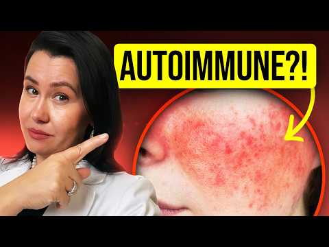 12 DANGEROUS Signs of Autoimmune Disease