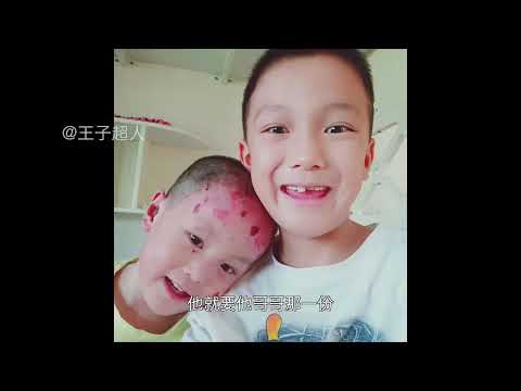 妈妈：让我们多承受一点他少受一点，我们会开心一点 #蝴蝶宝贝 #罕见病 #纪录片 #妈妈 #母爱 @琼