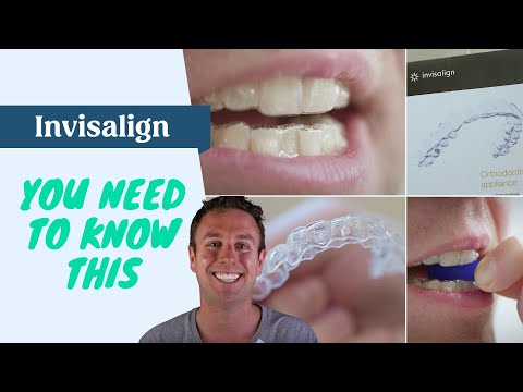 40 Invisalign tips you need to know