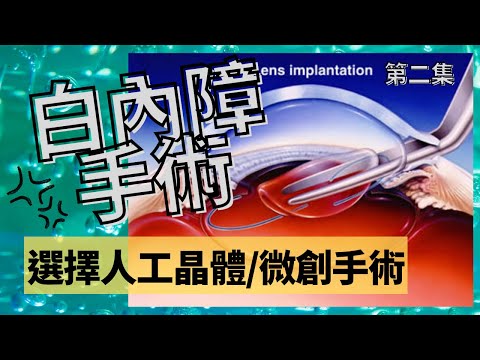 [白內障手術] 怎樣選擇人造晶體 IOL 可同時矯正老花散光近視 飛秒雷射 微創手術  單眼融視 鴛鴦眼手術 Monovision Optician