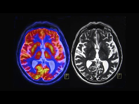 The Neuroscience of Real Life Monsters: Psychopaths, CEOs, & Politicians (Science on Tap Livestream)