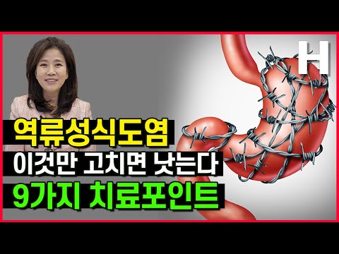 역류성식도염 스스로 고치기 이것만 고치면 낫는다! 음식 운동 베개 기침 스스로 낫는 법 총정리!
