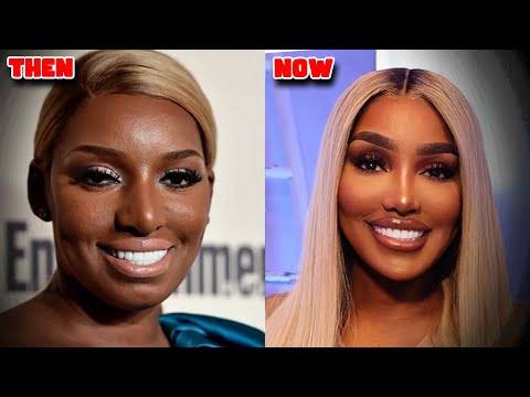 Real Housewives Who Completely Changed Their Face