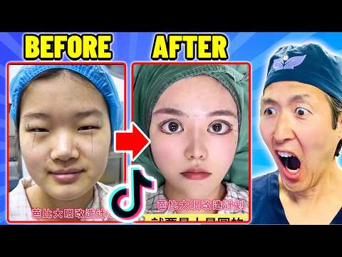 Plastic Surgeon Reacts to OUTRAGEOUS Viral TikTok Videos!