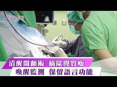 《新聞思想啟》 第189集  Part1 清醒開顱術 摘除膠質瘤  喚醒監測 保留語言功能