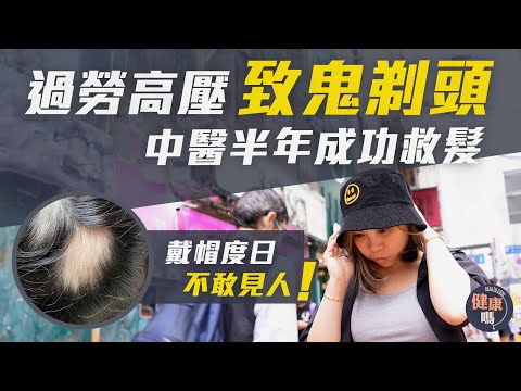 「鬼剃頭」睇西醫大半年  脫髮窿反由一個變三個｜轉中醫半年斑禿痊癒 兼改善長期失眠｜健康嗎@HealthCodeHK 【醫檔案】#斑禿 #鬼剃頭 #中醫