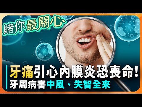 會致死！「輕忽牙痛」恐害細菌亂啃心臟瓣膜→害心內膜炎！不是洋蔥！營養師讚：「1辛香料」是牙周病剋星！「1類蛋餅」高蛋白、強補鈣 還能抗氧化、顧牙齒！｜祝你健康