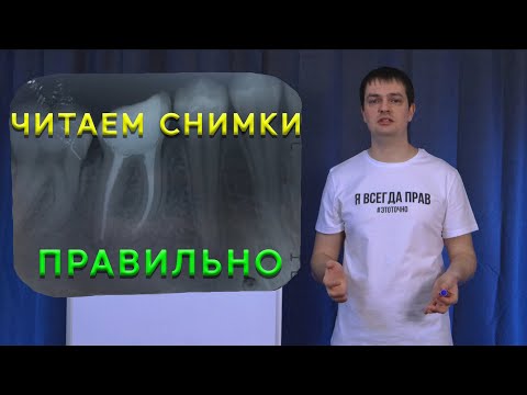 Снимки зубов - как читать правильно