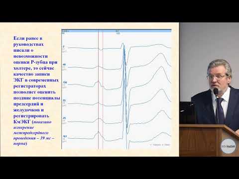 Современные возможности холтеровского мониторирования