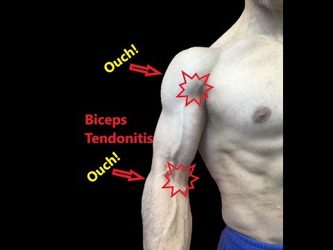 Biceps Tendonitis Treatment At Home (Relieve Pain Fast)