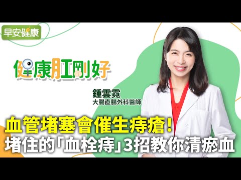血管堵塞會催生痔瘡！堵住的「血栓痔」3招教你清瘀血︱鍾雲霓 大腸直腸外科醫師【早安健康】