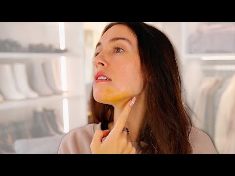 Getting FAKE Front Teeth...😢