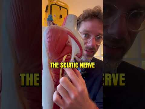 Is Your Back Pain Really Sciatica?