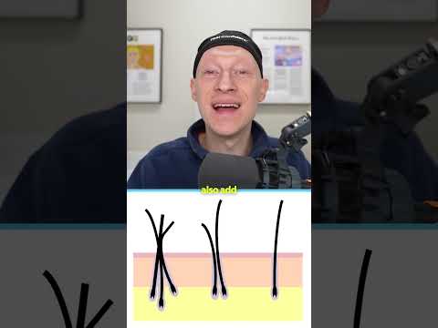 How To Get A *NATURAL* Hair Transplant Result