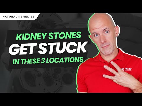 Kidney Stone Stuck? Symptoms, Pain Relief, and How to Pass It Fast!