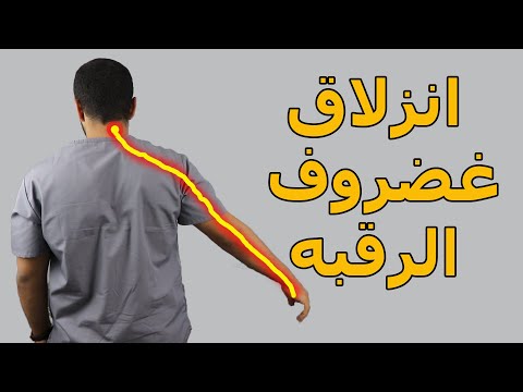 وداعا انزلاق غضروف الرقبة وتنميل وكهربة الايد بدون جراحة/بخطوتين بس تخلص من الانزلاق الغضروفي العنقي