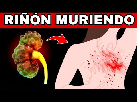 9 Signos en Tu Cuerpo que Tu RIÑÓN Da Antes de Morir + 8 Consejos para Salvar Tus Riñones AHORA