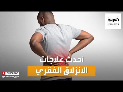 صباح العربية | ما أحدث علاجات الانزلاق الفقري؟
