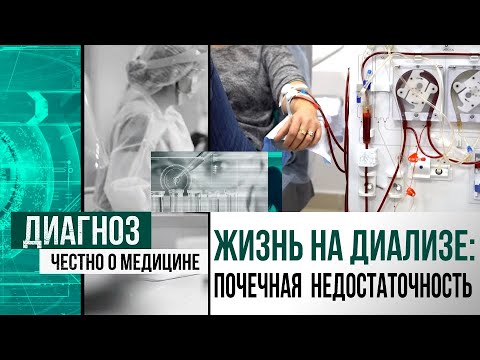 Искусственная почка: почему ранняя диагностика ХПН не в приоритете | Диагноз