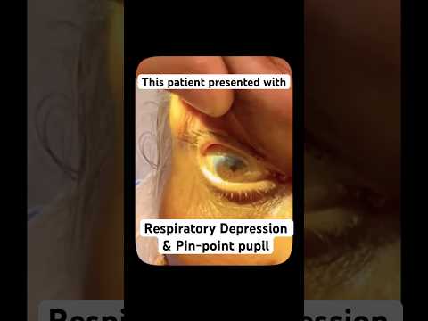 5 Important Antidotes which every doctor should know #emergency #icu #antidotes