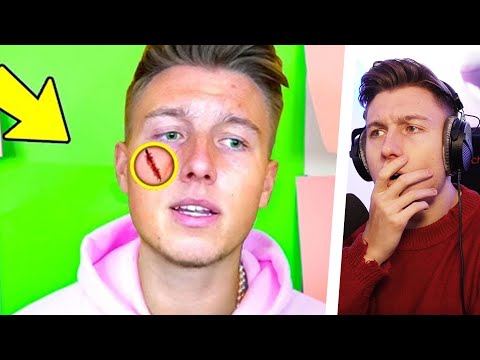 7 GRÜNDE WARUM Leute iCrimax HASSEN