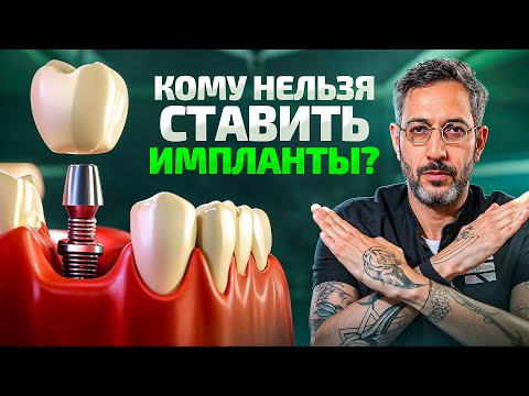НЕудобная правда про зубные импланты. Никогда их НЕ ставьте, если...