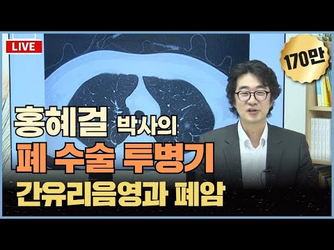 '홍혜걸 박사의 폐 수술 투병기, 간유리음영과 폐암'