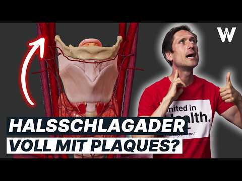 Verstopfte Halsschlagader: Typische Ursachen, wichtige Anzeichen und Folgen für Ihren Körper!