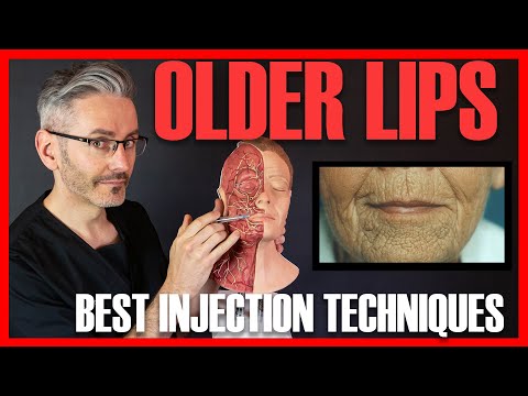 OLD LIPS: Best injection techniques & how to avoid the Homer Simpson look! [Aesthetics Mastery Show]