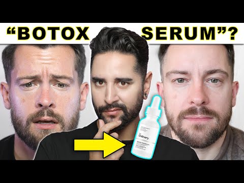 BOTOX In A Bottle VS ACTUAL Botox! The Ordinary’s Argireline Solution 🤔