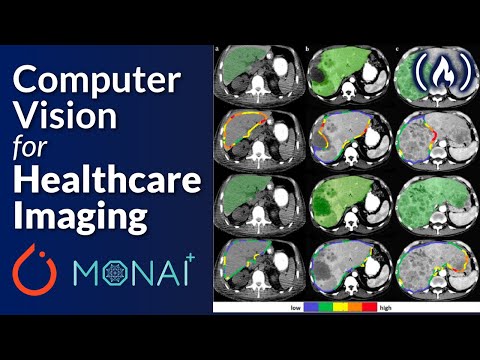 PyTorch and Monai for AI Healthcare Imaging - Python Machine Learning Course