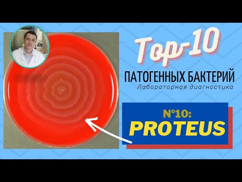 Патогенные бактерии рода Proteus (протеи). Подробный лабораторный обзор (2020)