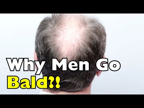Why Do Some Men Get Bald as They Grow Older? [ID0906]