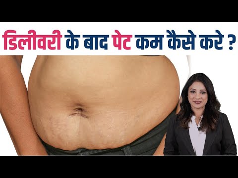 डिलीवरी के बाद पेट कम कैसे करे || How to Reduce Belly Fat after Pregnancy ||