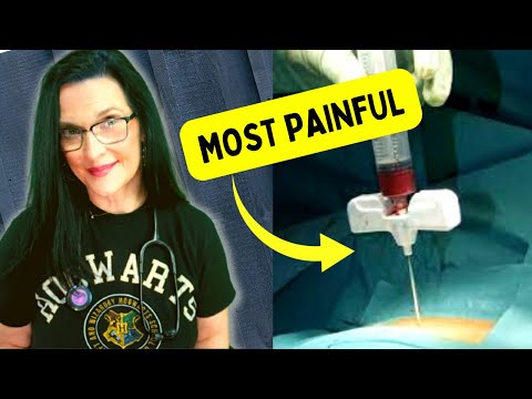 The Top 7 MOST Painful Surgical Procedures Ever