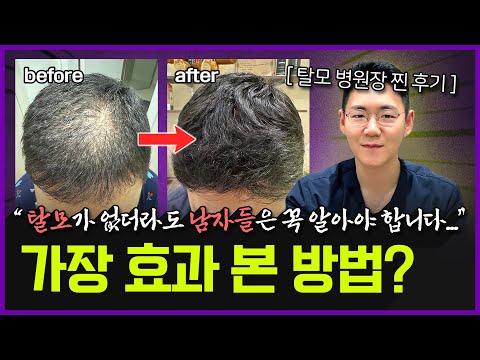 '이걸' 모르니까 머리가 계속 빠지는 겁니다… | 카이스트 출신 의사가 탈모에 진짜 효과 본 방법 5가지
